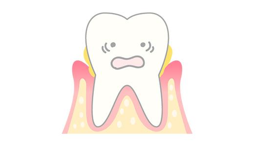 歯周病の原因